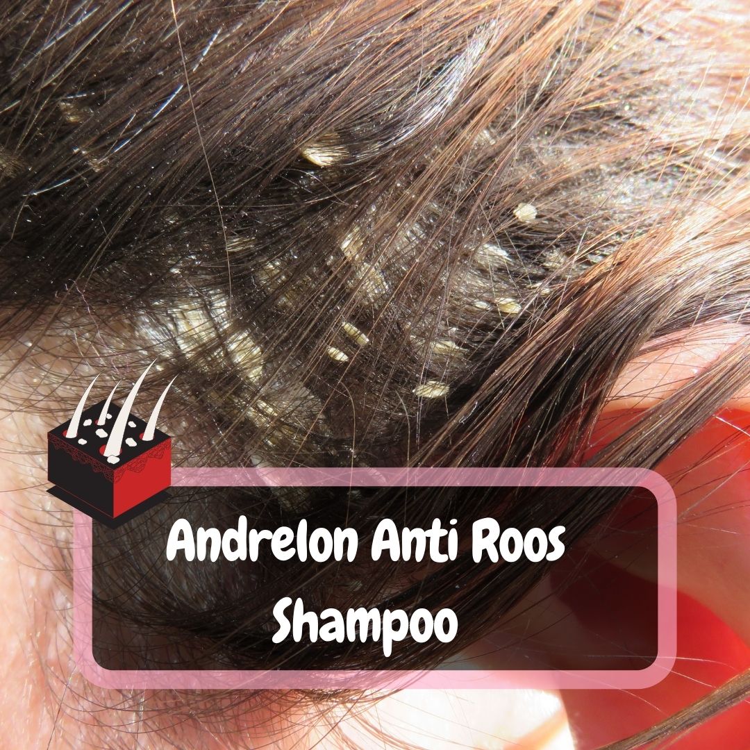 passie Continent essence Andrelon Anti Roos Shampoo Review: Mannen en Vrouwen - BeautyGaze