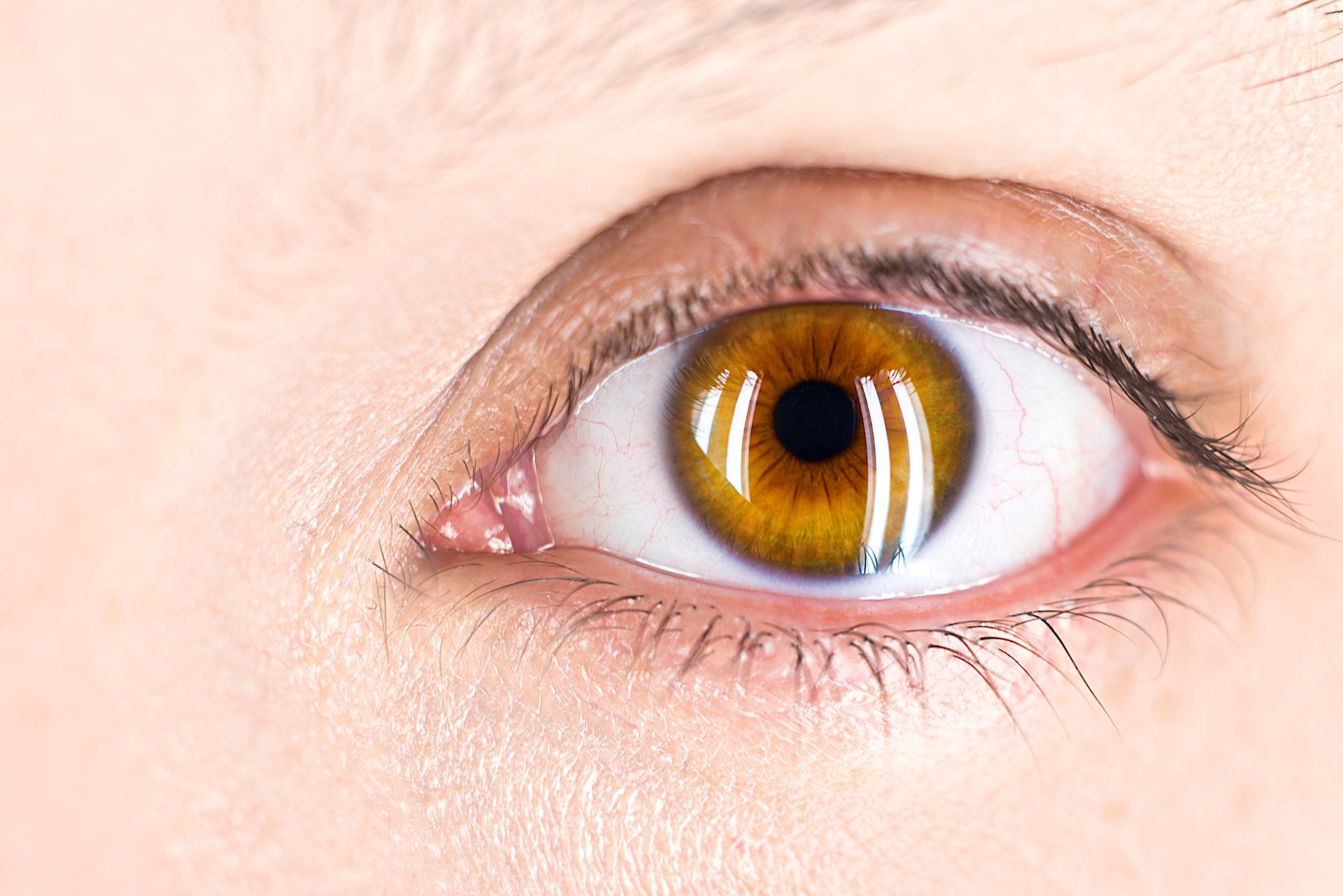 Waarom oogverzorging zo belangrijk is